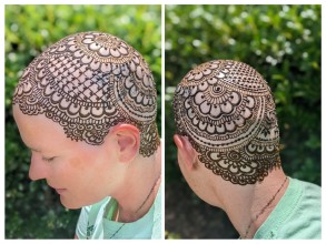 Henna crown on the head for patients losing hair